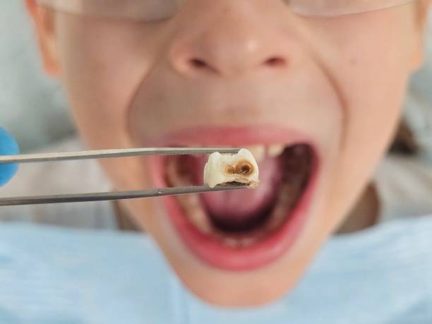 Best Same-Day Emergency Dentist in Garland, NC